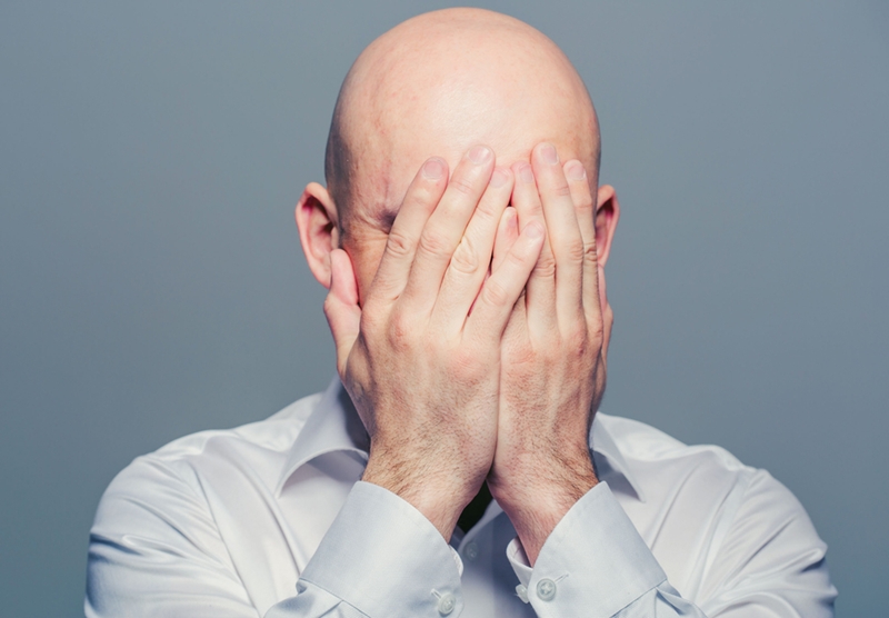 Balding men often experience symptoms of depression and anxiety.